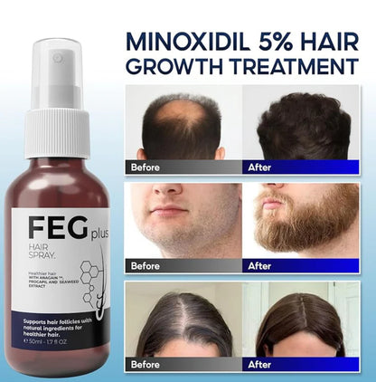 FEG Hair Growth Spray - Promotes Natural Hair Growth